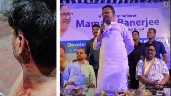 TMC group clash in belgachia kolkata infront of Firhad hakim