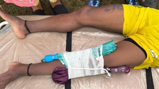 CFL Match Medical Emergency Controversy