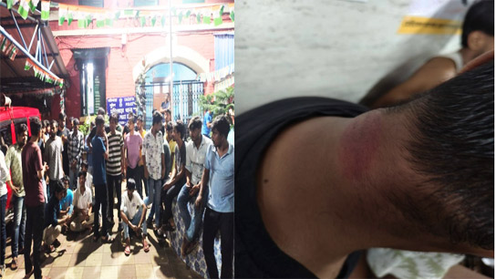 Calcutta University Students Beaten