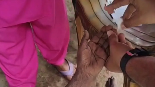Visceral leishmaniasis patient found in Bankura, new concerns growing?