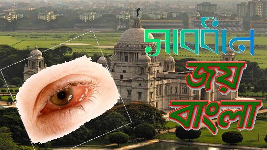 Viral and allergic conjunctivitis on the rise in Kolkata, doctors wary of red eyes
