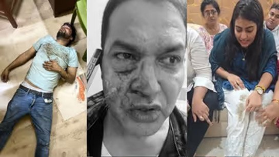 'I haven't seen him in 31 years', blood gushing from his face! Former IPS officer Humayun Kabir covered in blood in East Jadavpur